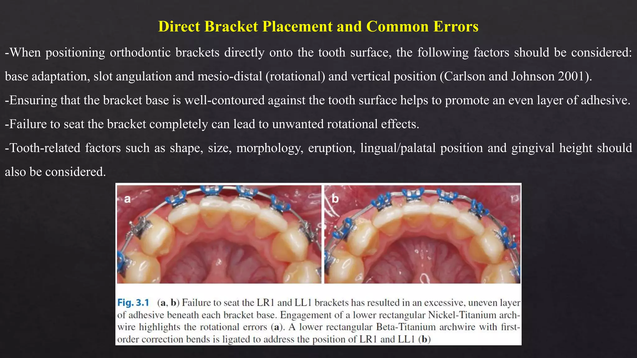 Bracket placement and positioning (dr nayaungbds phd) | PPTX