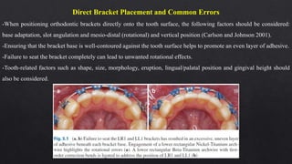 Direct Bracket Placement and Common Errors
-When positioning orthodontic brackets directly onto the tooth surface, the following factors should be considered:
base adaptation, slot angulation and mesio-distal (rotational) and vertical position (Carlson and Johnson 2001).
-Ensuring that the bracket base is well-contoured against the tooth surface helps to promote an even layer of adhesive.
-Failure to seat the bracket completely can lead to unwanted rotational effects.
-Tooth-related factors such as shape, size, morphology, eruption, lingual/palatal position and gingival height should
also be considered.
 