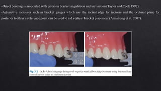 -Direct bonding is associated with errors in bracket angulation and inclination (Taylor and Cook 1992).
-Adjunctive measures such as bracket gauges which use the incisal edge for incisors and the occlusal plane for
posterior teeth as a reference point can be used to aid vertical bracket placement (Armstrong et al. 2007).
 