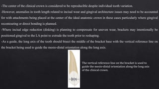 -The center of the clinical crown is considered to be reproducible despite individual tooth variation.
-However, anomalies in tooth length related to incisal wear and gingival architecture issues may need to be accounted
for with attachments being placed at the center of the ideal anatomic crown in these cases particularly where gingival
recontouring or direct bonding is planned.
-Where incisal edge reduction (disking) is planning to compensate for uneven wear, brackets may intentionally be
positioned gingival to the LA point to extrude the tooth prior to reshaping.
-As a guide, the long axis of the tooth should bisect the middle of the bracket base with the vertical reference line on
the bracket being used to guide the mesio-distal orientation along the long axis.
The vertical reference line on the bracket is used to
guide the mesio-distal orientation along the long axis
of the clinical crown.
 