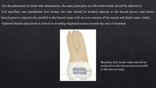 -For the placement of molar tube attachments, the same principles as with molar bands should be adhered to.
-For maxillary and mandibular first molars, the tube should be bonded adjacent to the buccal groove and mesio-
buccal groove, respectively, parallel to the buccal cusps with an even amount of the mesial and distal cusps visible.
-Optimal bracket placement is critical in avoiding alignment issues towards the end of treatment.
Maxillary first molar tubes should be
centered on the buccal groove parallel
to the buccal cusps.
 