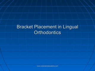 Bracket Placement in LingualBracket Placement in Lingual
OrthodonticsOrthodontics
www.indiandentalacademy.comwww.indiandentalacademy.com
 
