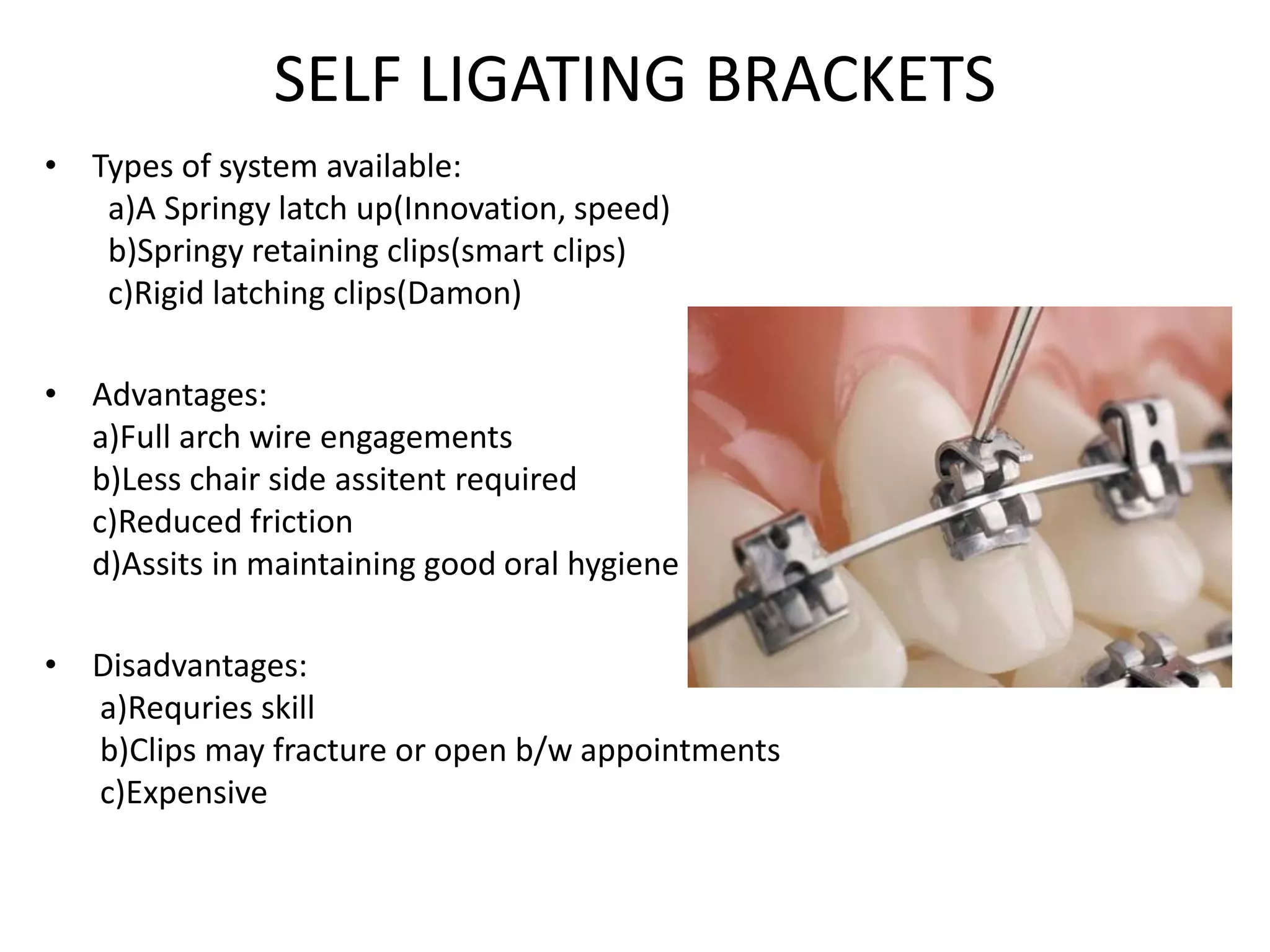 Bracket prescription(Orthodontics) PPT