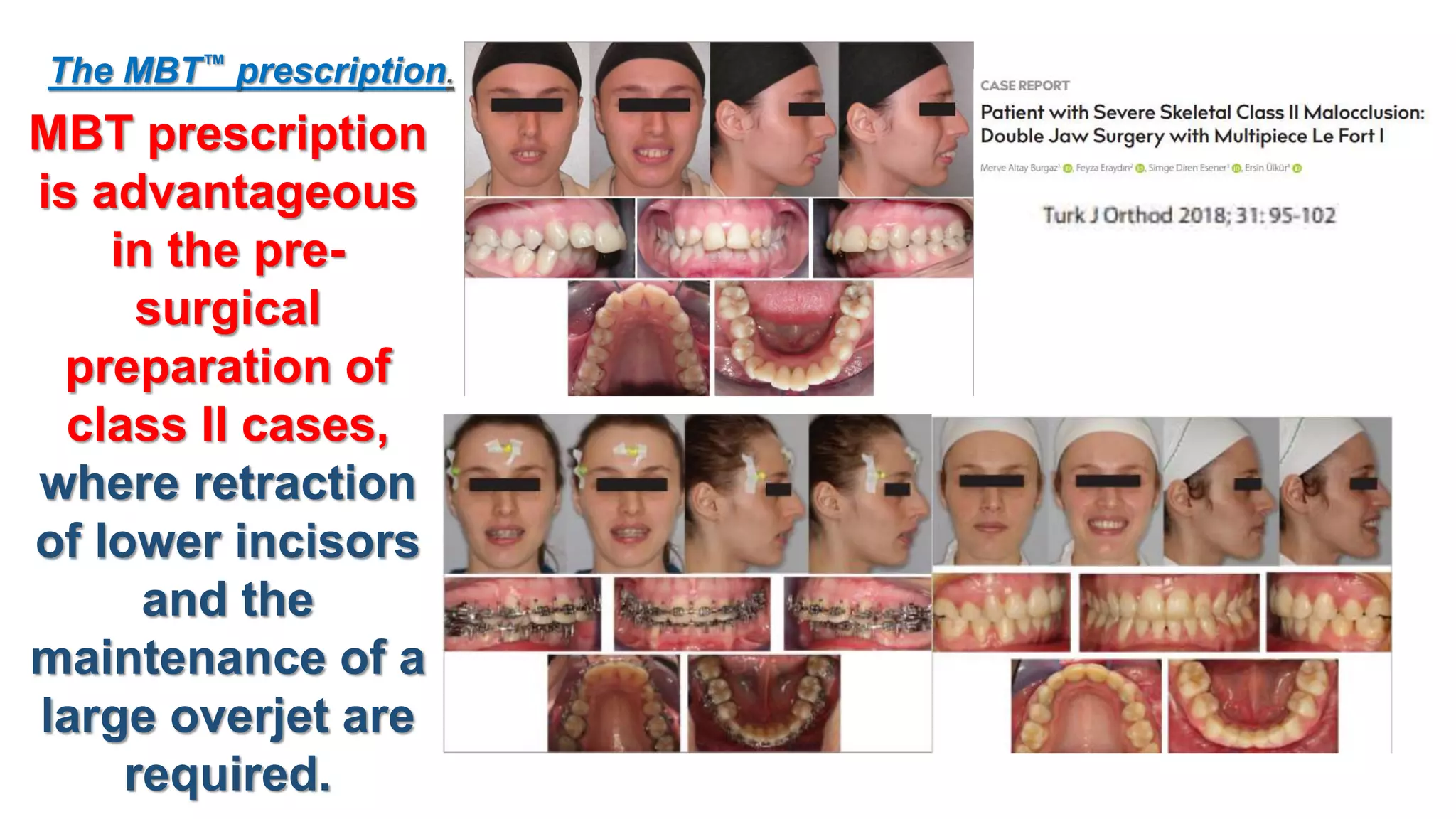 Orthodontic Bracket Prescription 1 PPTX orthodontic-bracket-prescription-1-pptx