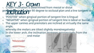KEY 3- Crown
inclination
1. Crown inclination is determined from mesial or distal
perspective
2. Angle form by a line 90 degree to occlusal plan and a line tangent to
bracke position.
3. 'POSITIVE" when gingival portion of tangent line is lingual
4. "NEGATIVE" when gingival portion of tangent line is labial or buccal.
5. The upper canines and premolars are inclined at virtually the same
angle,
whereby the molars are tilted slightly more(negatively)
6. In the lower arch, the inclination increases progressively from the
canine to the second molar
 