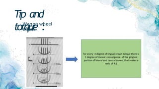 Tip and
torque :
• Wagon wheel
effect :
 