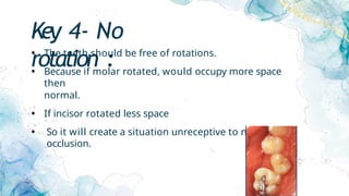 Key 4- No
rotation :
• The teeth should be free of rotations.
• Because if molar rotated, would occupy more space
then
normal.
• If incisor rotated less space
• So it will create a situation unreceptive to normal
occlusion.
 