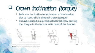  Crown inclination (torque)
 Refers to the built—in inclination of the bracket
slot to control labiolingual crown (torque)
 It maybe placed in a preadjusted bracket by putting
the torque in the face or in its base of the bracket.
 