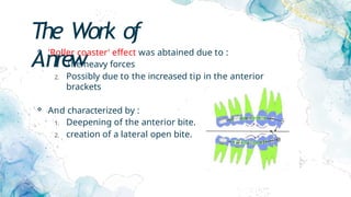 The Work of
Anrew
 'Roller coaster' effect was abtained due to :
1. The heavy forces
2. Possibly due to the increased tip in the anterior
brackets
 And characterized by :
1. Deepening of the anterior bite.
2. creation of a lateral open bite.
 