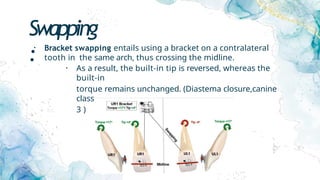 Swapping
:
• Bracket swapping entails using a bracket on a contralateral
tooth in the same arch, thus crossing the midline.
• As a result, the built-in tip is reversed, whereas the
built-in
torque remains unchanged. (Diastema closure,canine
class
3 )
 