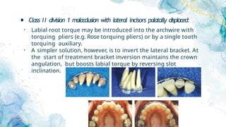 • Class II division 1 malocclusion with lateral incisors palatally displaced:
• Labial root torque may be introduced into the archwire with
torquing pliers (e.g. Rose torquing pliers) or by a single tooth
torquing auxiliary.
• A simpler solution, however, is to invert the lateral bracket. At
the start of treatment bracket inversion maintains the crown
angulation, but boosts labial torque by reversing slot
inclination.
 