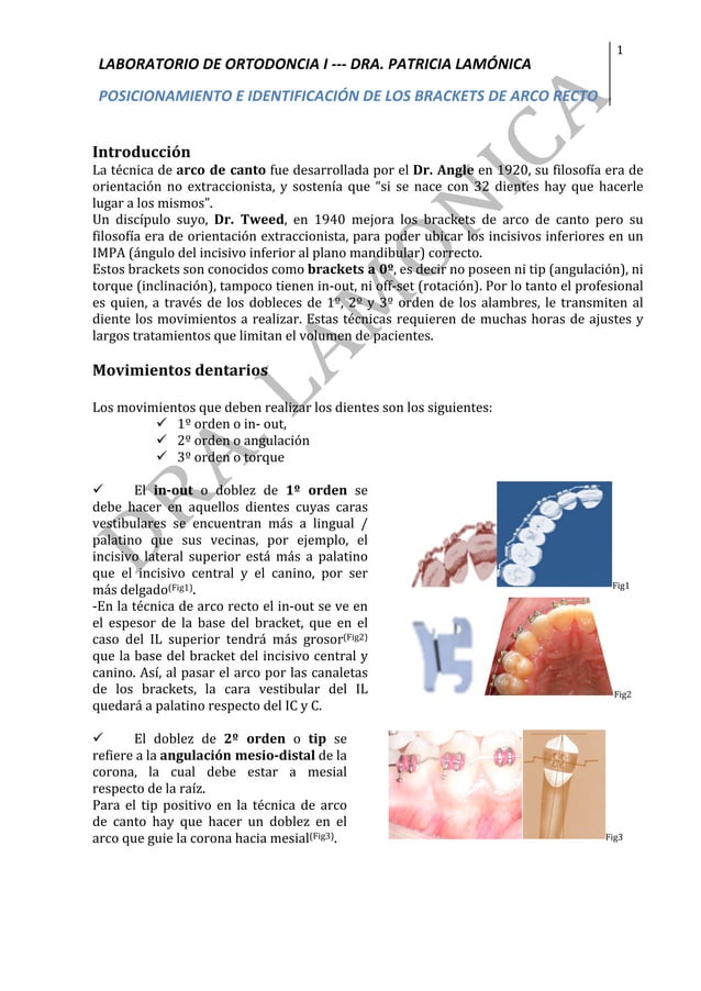 Posicionamiento e identificación de Brackets arco recto | PDF