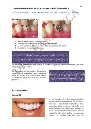 LABORATORIO	DE	ORTODONCIA	I	---	DRA.	PATRICIA	LAMÓNICA	
POSICIONAMIENTO	E	IDENTIFICACIÓN	DE	LOS	BRACKETS	DE	ARCO	RECTO	
13	
	
	
Pasos	para	cementar	el	bracket.	
										 	
	
1. Marcar	el	eje	largo	de	la	corona	clínica.	
2. Ubicar	el	bracket	sobre	el	eje	largo	en	el	punto	EM.	
3. La	línea	vertical	del	bracket	debe	coincidir	con	el	eje	del	diente.	
4. Corroborar	con	visión	indirecta	
	
Dr.	Andrews		cementa	los	brackets	en	el	centro	del	eje	largo	de	la	corona	clínica,	es	decir	
sobre	el	punto	EM	o	FA.	
	
Dr.	Roth	cementa	los	brackets	de	canino	a	
canino,	 tanto	 superiores	 como	 inferiores,	
entre	0,5	a	1mm	más	a	incisal	para	nivelar	
la	 curva	 de	 Spee	 en	 casos	 de	 mordida	
profunda.	
	
	
Bracket	Estético		
Inspire	ICE		
	
Es	 un	 bracket	 de	 zafiro	 monocristalino,	
transparente	 como	 el	 cristal,	 virtualmente	
invisible.	 Tiene	 forma	 romboide	 y	 base	
específica	 para	 el	 diente.	 La	 malla	 está	
confeccionada	 con	 bolas	 que	 reducen	 la	
fuerza	de	decementación	requerida.	Poseen	
superficie	ultra	suave	pulida	con	calor	que	
reduce	 la	 fricción	 favorable	 para	 la	
	
 