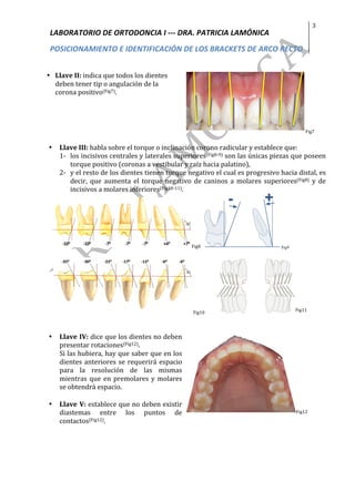 LABORATORIO	DE	ORTODONCIA	I	---	DRA.	PATRICIA	LAMÓNICA	
POSICIONAMIENTO	E	IDENTIFICACIÓN	DE	LOS	BRACKETS	DE	ARCO	RECTO	
3	
	
	
• Llave	II:	indica	que	todos	los	dientes	
deben	tener	tip	o	angulación	de	la	
corona	positivo(Fig7).	
Fig7	
	
• Llave	III:	habla	sobre	el	torque	o	inclinación	corono	radicular	y	establece	que:	
1- los	incisivos	centrales	y	laterales	superiores(Fig8-9)	son	las	únicas	piezas	que	poseen	
torque	positivo	(coronas	a	vestibular	y	raíz	hacia	palatino),		
2- y	el	resto	de	los	dientes	tienen	torque	negativo	el	cual	es	progresivo	hacia	distal,	es	
decir,	 que	 aumenta	 el	 torque	 negativo	 de	 caninos	 a	 molares	 superiores(Fig8)	 y	 de	
incisivos	a	molares	inferiores(Fig10-11).	
			 Fig8 Fig9
				 	Fig10											
Fig11	
	
	
• Llave	IV:	dice	que	los	dientes	no	deben	
presentar	rotaciones(Fig12).		
Si	las	hubiera,	hay	que	saber	que	en	los	
dientes	anteriores	se	requerirá	espacio	
para	 la	 resolución	 de	 las	 mismas	
mientras	que	en	premolares	y	molares	
se	obtendrá	espacio.		
	
• Llave	V:	establece	que	no	deben	existir	
diastemas	 entre	 los	 puntos	 de	
contactos(Fig12).		
Fig12	
	
	
	
	
	
	
	
	
 