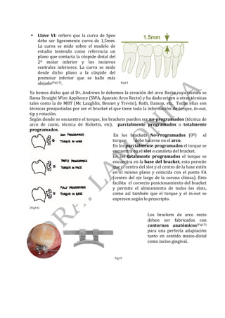 • Llave	 VI:	 refiere	 que	 la	 curva	 de	 Spee	
debe	 ser	 ligeramente	 curva	 de	 1,5mm.		
La	 curva	 se	 mide	 sobre	 el	 modelo	 de	
estudio	 teniendo	 como	 referencia	 un	
plano	que	contacta	la	cúspide	distal	del	
2º	 molar	 inferior	 y	 los	 incisivos	
centrales	 inferiores.	 La	 curva	 se	 mide	
desde	 dicho	 plano	 a	 la	 cúspide	 del	
premolar	 inferior	 que	 se	 halle	 más	
alejado(Fig13).		
	
Fig13	
	
Ya	hemos	dicho	que	al	Dr.	Andrews	le	debemos	la	creación	del	arco	Recto	cuya	técnica	se	
llama	Straight	Wire	Applience	(SWA,	Aparato	Arco	Recto)	y	ha	dado	origen	a	otras	técnicas	
tales	como	la	de	MBT	(Mc	Laughlin,	Bennet	y	Trevisi),	Roth,	Damon,	etc.		Todas	ellas	son	
técnicas	preajustadas	por	ser	el	bracket	el	que	tiene	toda	la	información	de	torque,	in-out,	
tip	y	rotación.		
Según	donde	se	encuentre	el	torque,	los	brackets	pueden	ser	no-programados	(técnica	de	
arco	 de	 canto,	 técnica	 de	 Ricketts,	 etc),	 	 parcialmente	 programados	 o	 totalmente	
programados.	
(Fig14)	
																En	 los	 brackets	 No-Programados	 (0º)	 	 el	
torque									debe	hacerse	en	el	arco.	
En	los	parcialmente	programados	el	torque	se	
encuentra	en	el	slot	o	canaleta	del	bracket.	
En	 los	 totalmente	 programados	 el	 torque	 se	
encuentra	en	la	base	del	bracket,	esto	permite	
que	el	centro	del	slot	y	el	centro	de	la	base	estén	
en	 el	 mismo	 plano	 y	 coincida	 con	 el	 punto	 FA	
(centro	del	eje	largo	de	la	corona	clínica).	Esto	
facilita		el	correcto	posicionamiento	del	bracket	
y	 permite	 el	 alineamiento	 de	 todos	 los	 slots,	
como	 así	 también	 que	 el	 torque	 y	 el	 in-out	 se	
expresen	según	lo	prescripto.	
	
	
	
	
Fig15	
Los	 brackets	 de	 arco	 recto	
deben	 ser	 fabricados	 con	
contornos	 anatómicos(Fig15)	
para	 una	 perfecta	 adaptación	
tanto	 en	 sentido	 mesio-distal	
como	inciso	gingival.	
	
	
	
	
 