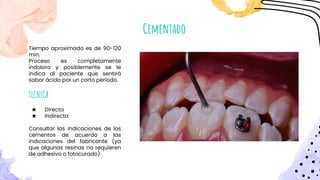 Cementado
Tiempo aproximado es de 90-120
min.
Proceso es completamente
indoloro y posiblemente se le
indica al paciente que sentirá
sabor ácido por un corto periodo.
TECNICA
★ Directa
★ Indirecta
Consultar las indicaciones de los
cementos de acuerdo a las
indicaciones del fabricante (ya
que algunas resinas no requieren
de adhesivo o fotocurado)
 