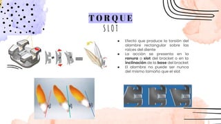 ● Efecto que produce la torsión del
alambre rectangular sobre las
raíces del diente
● La acción se presenta en la
ranura o slot del bracket o en la
inclinación de la base del bracket
● El alambre no puede ser nunca
del mismo tamaño que el slot
T O R Q U E
S L O T
 