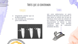 ● Angulación precisa que se
le dará al diente
● Los brackets son exclusivos
para cada diente.
torque
Partes que lo conforman
son unos aditamentos un poco
diferente del resto de los brackets. el
tubo tiene un orificio por el que se
introduce. Estos tubos se colocan en
los molares y se pueden cementar
directamente al diente o bien
colocarlos sobre unas bandas
metálicas que se colocarán
alrededor de éste.
Tubos
 