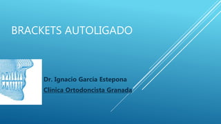 BRACKETS AUTOLIGADO
Dr. Ignacio García Estepona
Clínica Ortodoncista Granada
 