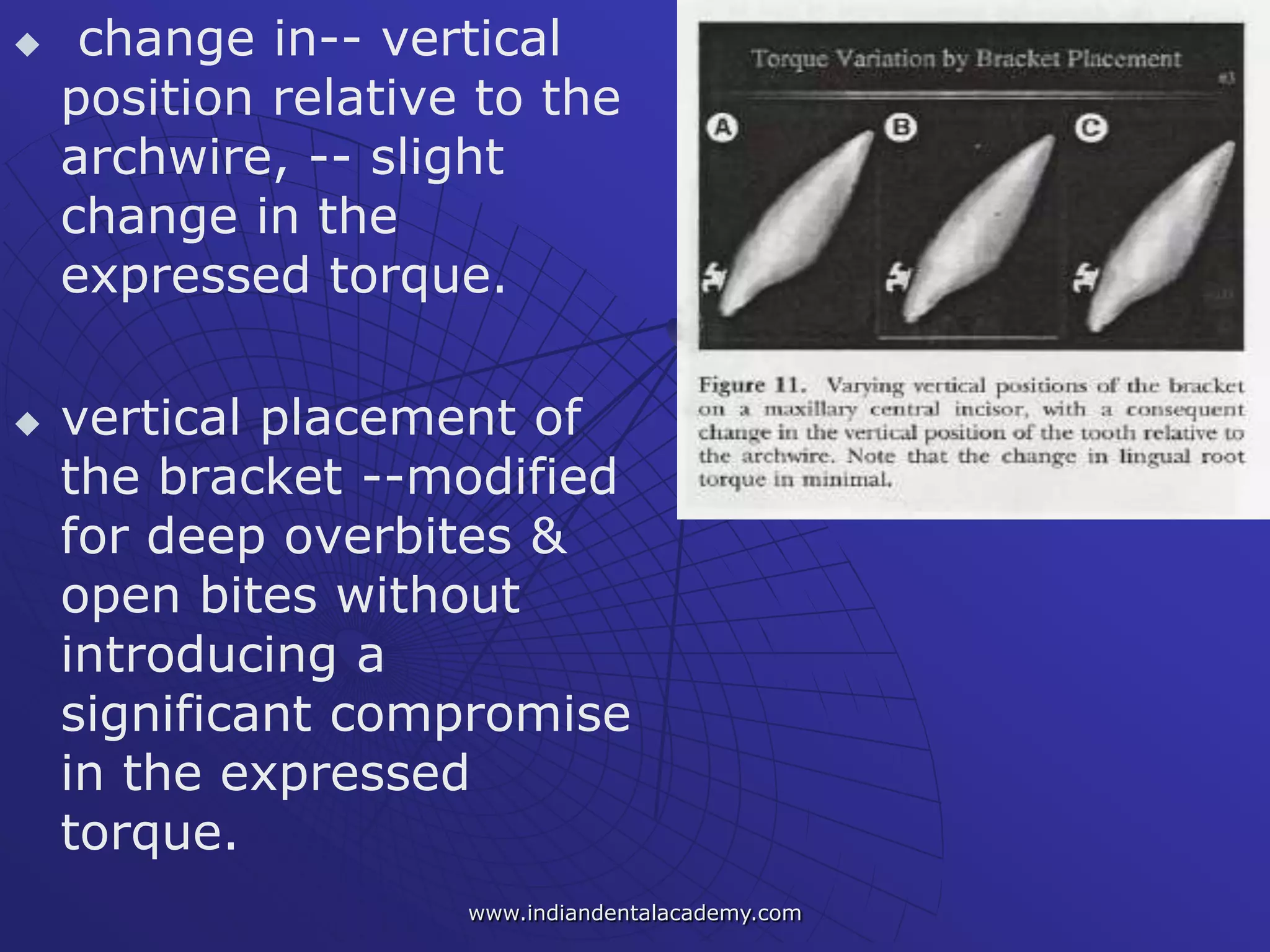  change in-- vertical
position relative to the
archwire, -- slight
change in the
expressed torque.
 vertical placement of
the bracket --modified
for deep overbites &
open bites without
introducing a
significant compromise
in the expressed
torque.
www.indiandentalacademy.com
 