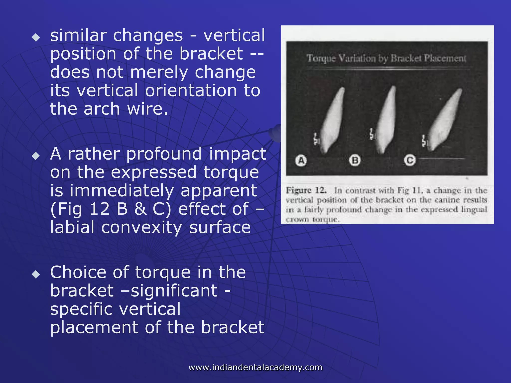  similar changes - vertical
position of the bracket --
does not merely change
its vertical orientation to
the arch wire.
 A rather profound impact
on the expressed torque
is immediately apparent
(Fig 12 B & C) effect of –
labial convexity surface
 Choice of torque in the
bracket –significant -
specific vertical
placement of the bracket
www.indiandentalacademy.com
 