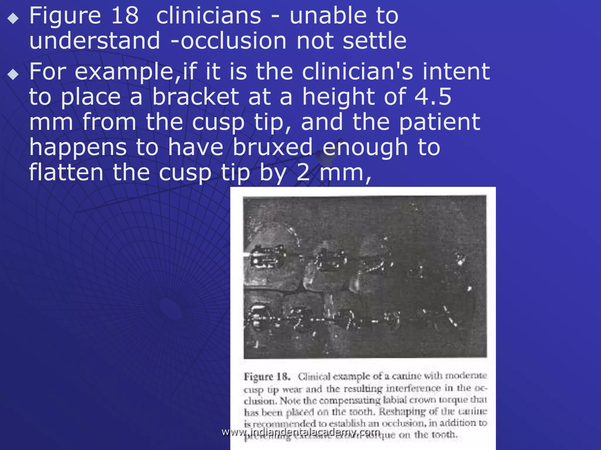  Figure 18 clinicians - unable to
understand -occlusion not settle
 For example,if it is the clinician's intent
to place a bracket at a height of 4.5
mm from the cusp tip, and the patient
happens to have bruxed enough to
flatten the cusp tip by 2 mm,
www.indiandentalacademy.com
 