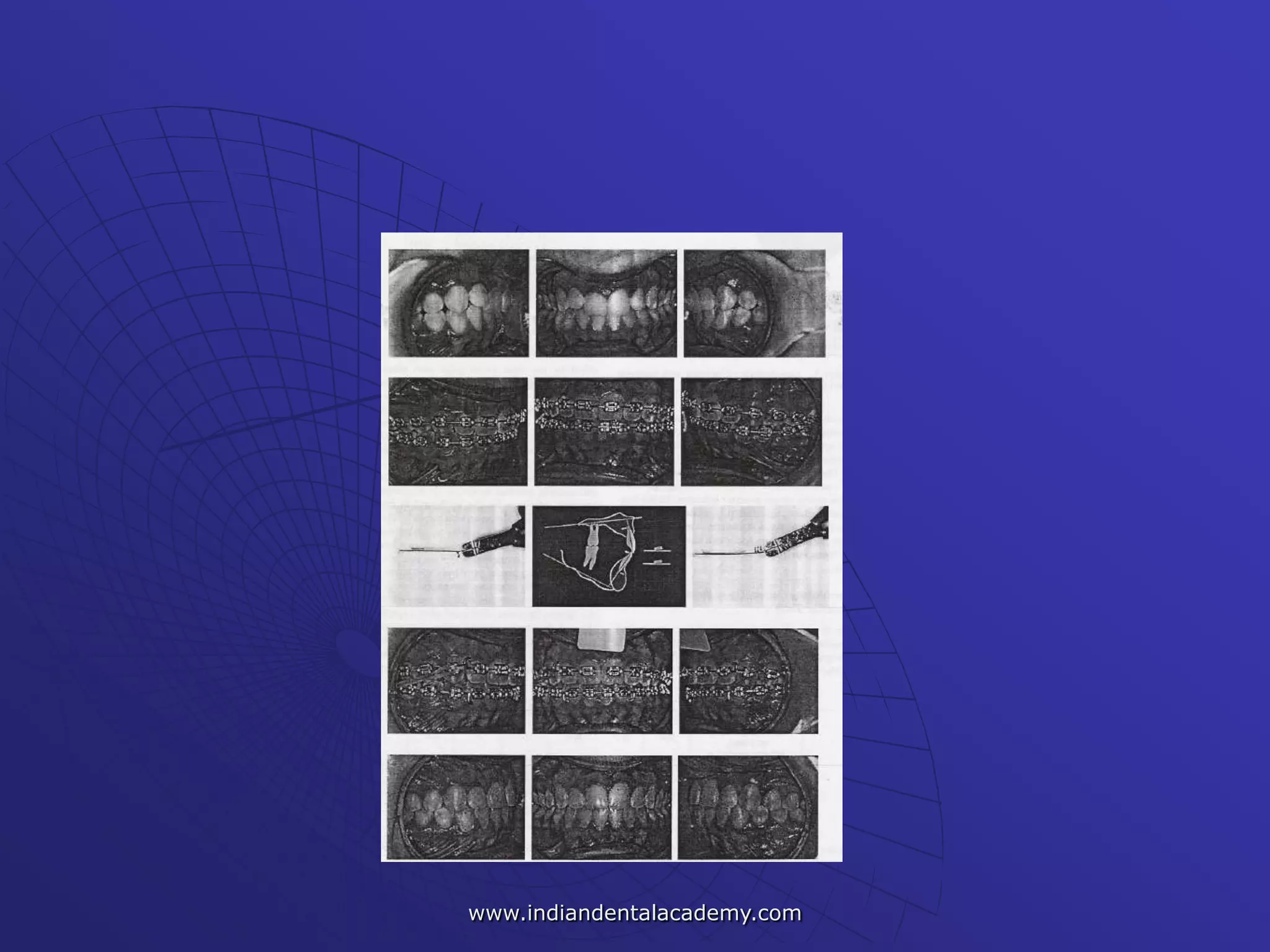 www.indiandentalacademy.com
 
