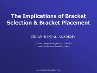 The Implications of Bracket
Selection & Bracket Placement
INDIAN DENTAL ACADEMY
Leader in continuing dental education
www.indiandentalacademy.com
www.indiandentalacademy.com
 