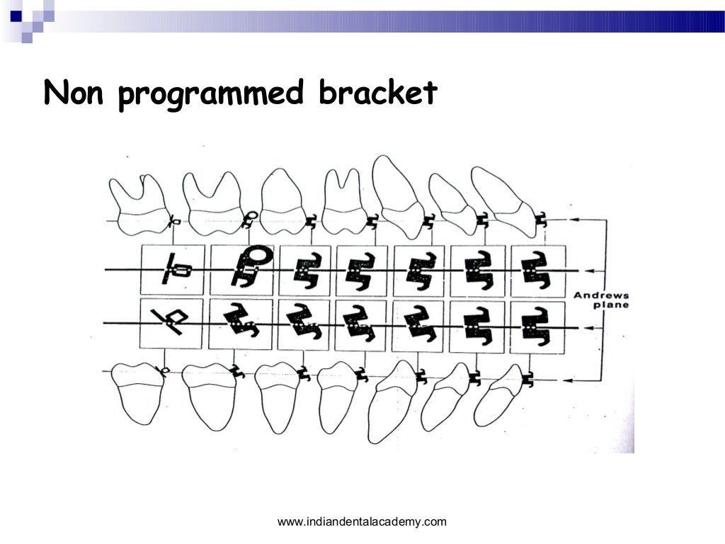 What Are Brackets Brackets Definition And Brackets Examples - Riset