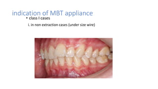 Mbt Class Brackets _versatility _ final (new).pptx