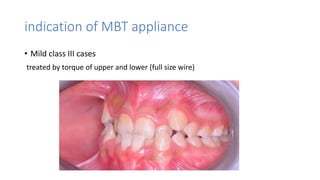 Mbt Class Brackets _versatility _ final (new).pptx