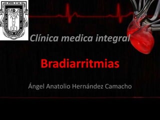Bradiarritmias
Ángel Anatolio Hernández Camacho
Clínica medica integral
 