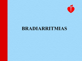 BRADIARRITMIAS
 