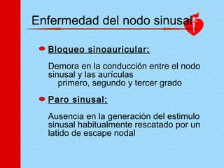 Enfermedad del nodo sinusal
Bloqueo sinoauricular:
Demora en la conducción entre el nodo
sinusal y las aurículas
primero, segundo y tercer grado
Paro sinusal;
Ausencia en la generación del estimulo
sinusal habitualmente rescatado por un
latido de escape nodal
 