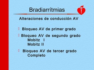 Bradiarrítmias
Alteraciones de conducción AV
 Bloqueo AV de primer grado
 Bloqueo AV de segundo grado
Mobitz I
Mobitz II
 Bloqueo AV de tercer grado
Completo
 