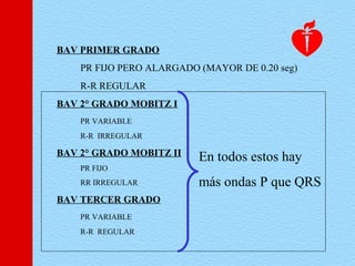 BAV PRIMER GRADO
PR FIJO PERO ALARGADO (MAYOR DE 0.20 seg)
R-R REGULAR
BAV 2° GRADO MOBITZ I
PR VARIABLE
R-R IRREGULAR
BAV 2° GRADO MOBITZ II
PR FIJO
RR IRREGULAR
BAV TERCER GRADO
PR VARIABLE
R-R REGULAR
En todos estos hay
más ondas P que QRS
 