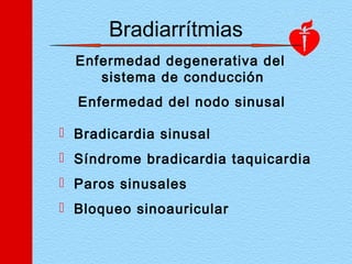 Bradiarrítmias
Enfermedad degenerativa del
sistema de conducción
 Bradicardia sinusal
 Síndrome bradicardia taquicardia
 Paros sinusales
 Bloqueo sinoauricular
Enfermedad del nodo sinusal
 