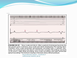 Braunwalds Heart Disease - A Textbook of
cardiovascular medicine, 9th ed.
 
