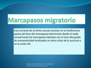 Esta variante de arritmia sinusal consiste en la trasferencia
pasiva del foco del marcapasos dominante desde el nodo
sinusal hasta los marcapasos latentes con el mas alto grado
de automaticidad localizados en otros sitios de la aurícula o
en la unión AV.
Braunwalds Heart Disease - A Textbook of
cardiovascular medicine, 9th ed.
 