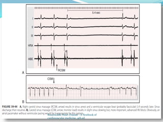 Braunwalds Heart Disease - A Textbook of
cardiovascular medicine, 9th ed.
 