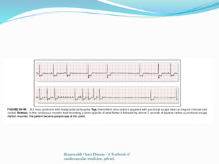 Braunwalds Heart Disease - A Textbook of
cardiovascular medicine, 9th ed.
 
