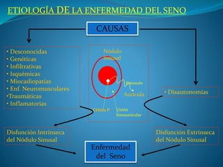 ETIOLOGÍA DE LA ENFERMEDAD DEL SENO
• Desconocidas
• Genéticas
• Infiltrativas
• Isquémicas
• Miocadiopatías
• Enf. Neuromusculares
•Traumáticas
• Inflamatorias
CAUSAS
Disfunción Intrínseca
del Nódulo Sinusal
• Disautonomías
Disfunción Extrínseca
del Nódulo Sinusal
Nódulo
Sinusal
Unión
Sinoauricular
Aurícula
Célula P
Estímulo
Enfermedad
del Seno
 