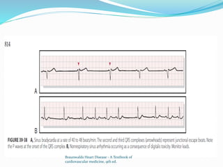 Braunwalds Heart Disease - A Textbook of
cardiovascular medicine, 9th ed.
 