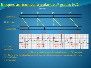 Bloqueo auriculoventricular de 1er grado: ECGCiclo
auricular
P
Unión AV
Ventrículo
P
P = Onda
auricular
PR: Tiempo de Conducción auriculoventricular prolongado y constante (> 0,21 s.)
TM
N
TMN = Tiempo máximo que debería de tener el PR para ser
normal
Aurícula
P P P P
P P P
PR PR PR PR
QRS QRS QRS QRS
QRS = Ondas
ventriculares
 