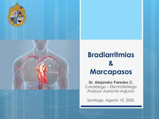 Bradiarritmias
&
Marcapasos
Dr. Alejandro Paredes C.
Cardiólogo – Electrofisiólogo
Profesor Asistente Adjunto
Santiago, Agosto 10, 2020.
 