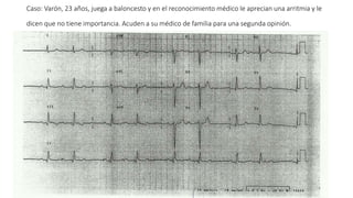 Caso: Varón, 23 años, juega a baloncesto y en el reconocimiento médico le aprecian una arritmia y le
dicen que no tiene importancia. Acuden a su médico de familia para una segunda opinión.
 
