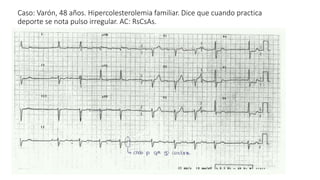 Caso: Varón, 48 años. Hipercolesterolemia familiar. Dice que cuando practica
deporte se nota pulso irregular. AC: RsCsAs.
 