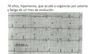 70 años, hipertenso, que acude a urgencias por astenia
y fatiga de un mes de evolución.
 