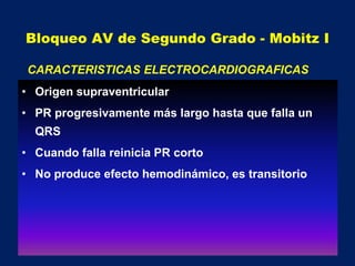Bloqueo AV de Segundo Grado - Mobitz I
• Origen supraventricular
• PR progresivamente más largo hasta que falla un
QRS
• Cuando falla reinicia PR corto
• No produce efecto hemodinámico, es transitorio
CARACTERISTICAS ELECTROCARDIOGRAFICAS
 