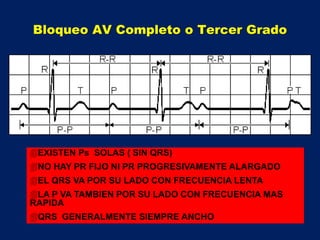 EXISTEN Ps SOLAS ( SIN QRS)
NO HAY PR FIJO NI PR PROGRESIVAMENTE ALARGADO
EL QRS VA POR SU LADO CON FRECUENCIA LENTA
LA P VA TAMBIEN POR SU LADO CON FRECUENCIA MAS
RAPIDA
QRS GENERALMENTE SIEMPRE ANCHO
Bloqueo AV Completo o Tercer Grado
 